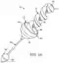 Fig. 02 - LOCKING GASTRIC OBSTRUCTION DEVICE AND METHOD OF USE