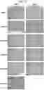 Fig. 03 - COMPOSITIONS FOR DRG-SPECIFIC REDUCTION OF TRANSGENE EXPRESSION