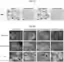 Fig. 07 - COMPOSITIONS FOR DRG-SPECIFIC REDUCTION OF TRANSGENE EXPRESSION