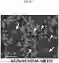 Fig. 12 - COMPOSITIONS FOR DRG-SPECIFIC REDUCTION OF TRANSGENE EXPRESSION