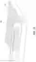 Fig. 16 - BIOLOGICAL DETECTION CARTRIDGE AND METHOD FOR PERFORMING THE SAME