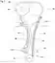 Fig. 02 - Chain drive system