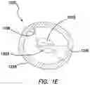 Fig. 04 - First-entry trocar system
