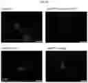 Fig. 07 - Pharmaceutical composition for preventing or treating degenerative brain disorders including HDL-APOM-S1P as active ingredient