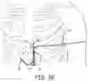 Fig. 09 - OPEN CHANNEL IMPLANT TOOLS AND IMPLANT TECHNIQUES UTILIZING SUCH TOOLS