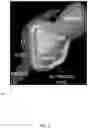 Fig. 08 - Three-dimensional radiotherapy dose distribution prediction
