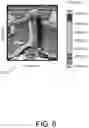 Fig. 09 - Three-dimensional radiotherapy dose distribution prediction