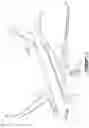 Fig. 02 - WIRE BRACE