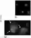 Fig. 05 - VESICLE-ENCAPSULATED SOCS