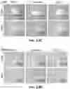 Fig. 52 - THERAPEUTIC EXTRACELLULAR VESICLES