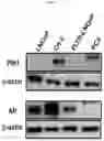 Fig. 02 - Pharmaceutical composition comprising THA as effective ingredient for treatment of prostate cancer