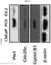 Fig. 03 - Pharmaceutical composition comprising THA as effective ingredient for treatment of prostate cancer