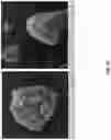 Fig. 93 - Eutectic formulations of cyclobenzaprine hydrochloride and amitriptyline hydrochloride