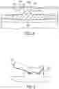 Fig. 09 - Mounting assemblies and methods for disposer installation