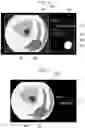 Fig. 05 - Medical image processing apparatus, medical image processing system, medical image processing method, and program