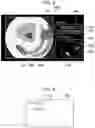 Fig. 07 - Medical image processing apparatus, medical image processing system, medical image processing method, and program