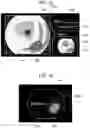 Fig. 10 - Medical image processing apparatus, medical image processing system, medical image processing method, and program