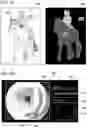 Fig. 16 - Medical image processing apparatus, medical image processing system, medical image processing method, and program
