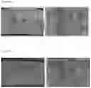 Fig. 11 - METHOD FOR MANUFACTURING LEAD-FREE RADIATION SHIELDING SHEET AND LEAD-FREE RADIATION SHIELDING SHEET