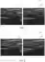 Fig. 09 - System and methods for tracking anatomical features in ultrasound images