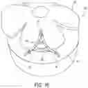Fig. 08 - Surgical constructs for tissue fixation and methods of tissue repairs