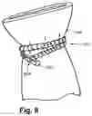 Fig. 09 - LOCKING SUTURE
