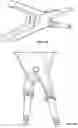 Fig. 16 - Rotational driver