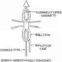 Fig. 01 - Systems, devices, and methods for forming anastomoses