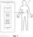 Fig. 02 - Systems, devices, and methods for forming anastomoses