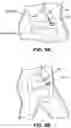 Fig. 06 - Systems, devices, and methods for forming anastomoses