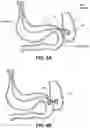 Fig. 07 - Systems, devices, and methods for forming anastomoses