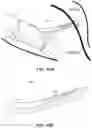 Fig. 47 - Systems, devices, and methods for forming anastomoses