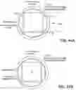 Fig. 52 - Systems, devices, and methods for forming anastomoses