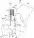 Fig. 01 - Guided punch for talar augments