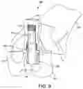 Fig. 07 - Guided punch for talar augments