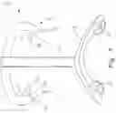 Fig. 04 - Surgical guides and implants having registration members