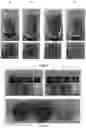 Fig. 03 - PROTECTING A BIOACTIVE AND/OR PRECURSOR THEREOF