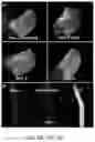 Fig. 02 - Polymeric Methylprednisolone Conjugates and Uses Thereof