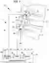 Fig. 02 - RODS WITH ELECTRICAL STIMULATION FOR PROMOTING BONE FUSION
