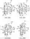 Fig. 32 - Structural reinforcement member for a vehicle body