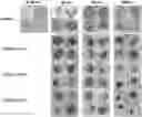 Fig. 01 - Antimalarial compounds, process for preparation and their use for drug resistant malaria