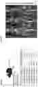 Fig. 30 - TARGETED GENE ACTIVATION USING MODIFIED GUIDE RNA