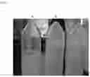 Fig. 02 - Synergistic antimicrobial formulation consisting of plant extract and lauric arginate