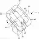 Fig. 01 - Button for anchoring of multiple sutures