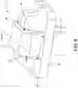 Fig. 08 - Button for anchoring of multiple sutures