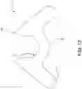 Fig. 15 - Button for anchoring of multiple sutures