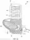 Fig. 04 - Surgical device for spinal fixation