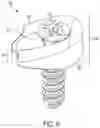 Fig. 07 - Compression force magnifier