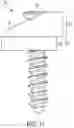 Fig. 12 - Compression force magnifier