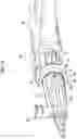 Fig. 12 - Endoscope treatment tool